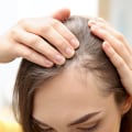 Understanding the Link Between Medical Conditions and Female Hair Loss