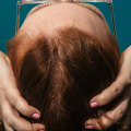 Understanding Menopause and Hair Loss