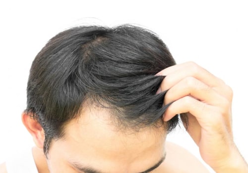 Scalp Treatments for Hair Growth: Tips and Techniques