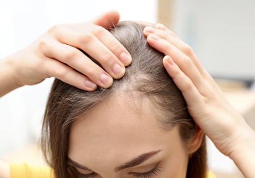 Understanding the Link Between Medical Conditions and Female Hair Loss